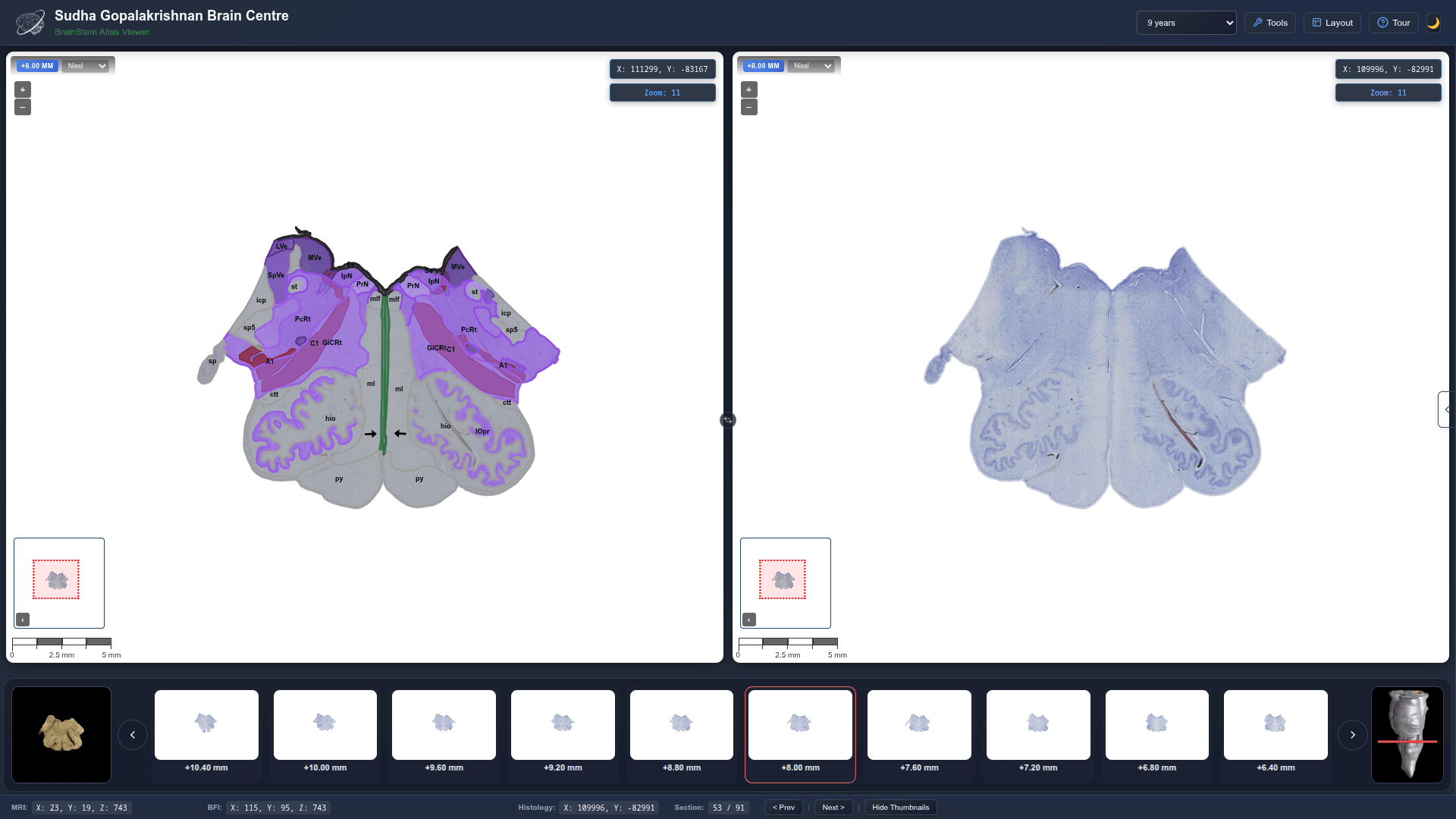 Best-Ever Brainstem Map Created by Indian Scientists